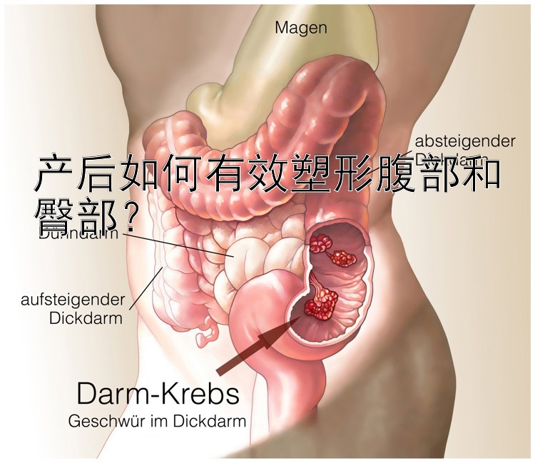 產(chǎn)后如何有效塑形腹部和臀部？