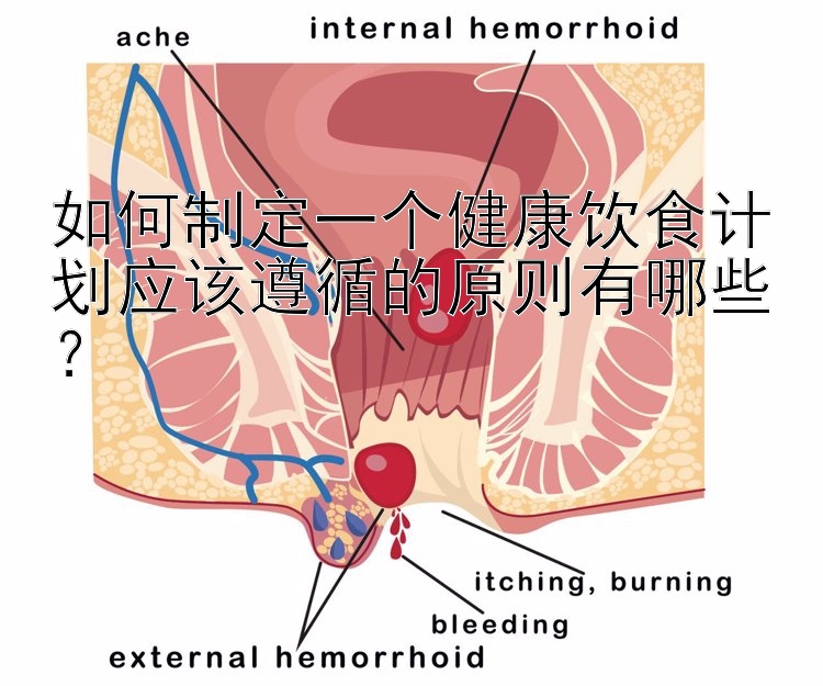 如何制定一個(gè)健康飲食計(jì)劃應(yīng)該遵循的原則有哪些？