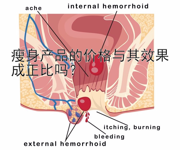 瘦身產(chǎn)品的價(jià)格與其效果成正比嗎？