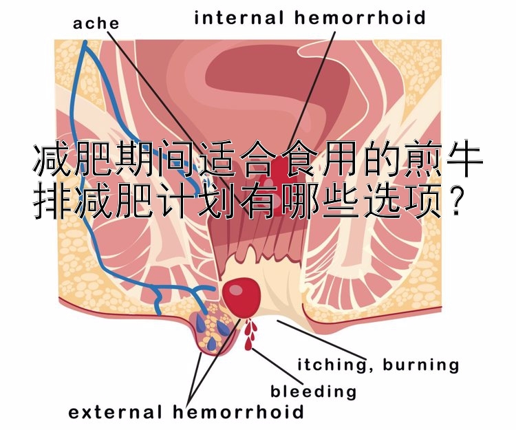 減肥期間適合食用的煎牛排減肥計劃有哪些選項？