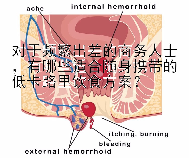 對(duì)于頻繁出差的商務(wù)人士，有哪些適合隨身攜帶的低卡路里飲食方案？