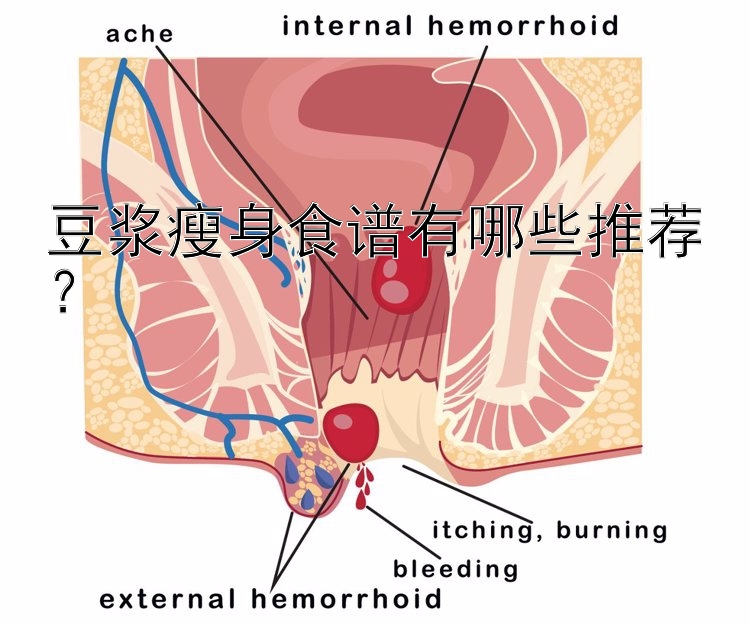 豆?jié){瘦身食譜有哪些推薦？