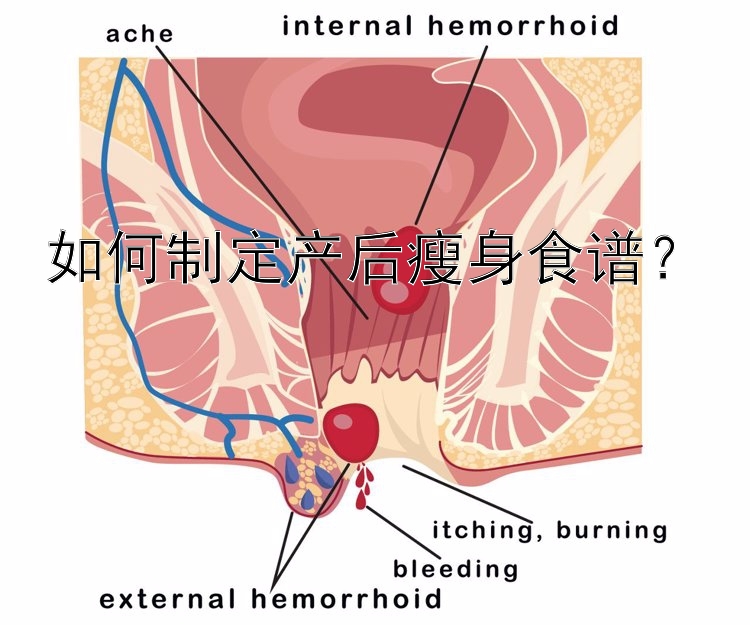 如何制定產(chǎn)后瘦身食譜？