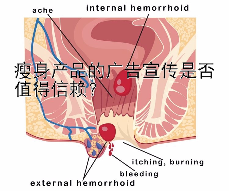 瘦身產(chǎn)品的廣告宣傳是否值得信賴？