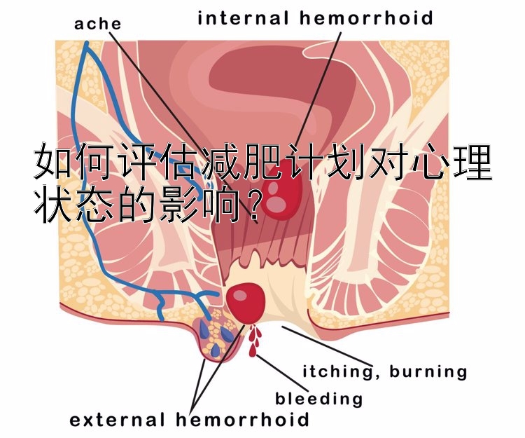 如何評(píng)估減肥計(jì)劃對(duì)心理狀態(tài)的影響？