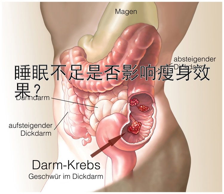 睡眠不足是否影響瘦身效果？