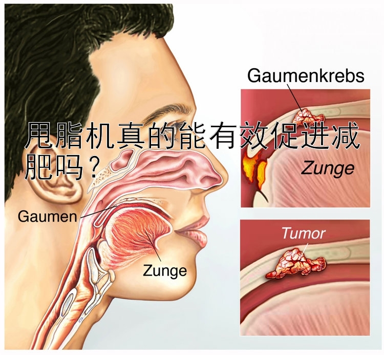 甩脂機(jī)真的能有效促進(jìn)減肥嗎？