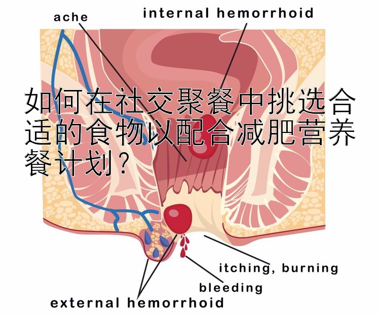 如何在社交聚餐中挑選合適的食物以配合減肥營(yíng)養(yǎng)餐計(jì)劃？