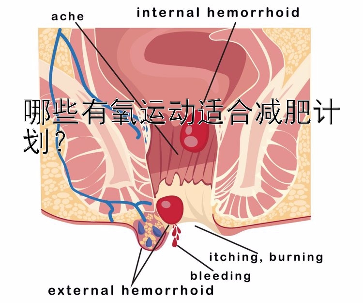 哪些有氧運(yùn)動適合減肥計(jì)劃？