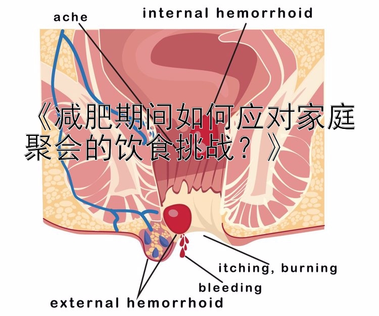 《減肥期間如何應(yīng)對家庭聚會(huì)的飲食挑戰(zhàn)？》