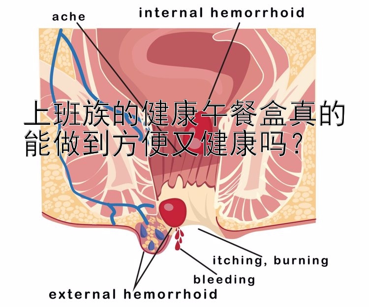 上班族的健康午餐盒真的能做到方便又健康嗎？