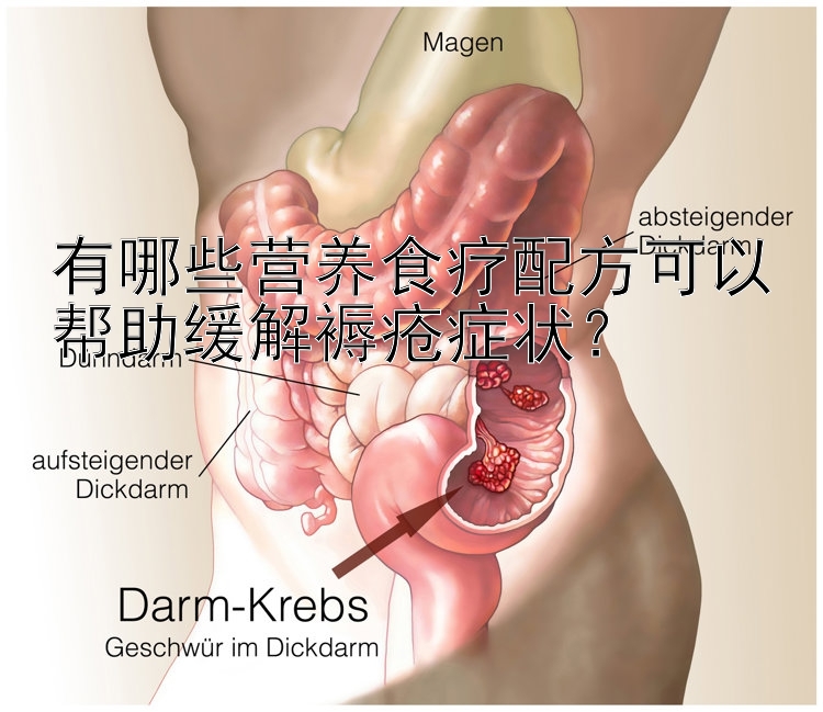 有哪些營養(yǎng)食療配方可以幫助緩解褥瘡癥狀？