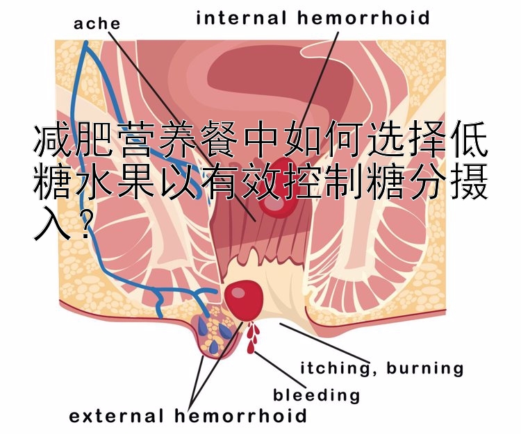 減肥營(yíng)養(yǎng)餐中如何選擇低糖水果以有效控制糖分?jǐn)z入？