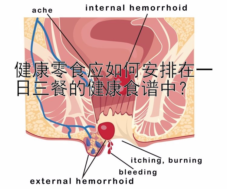 健康零食應(yīng)如何安排在一日三餐的健康食譜中？