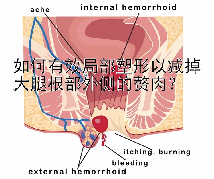 如何有效局部塑形以減掉大腿根部外側(cè)的贅肉？