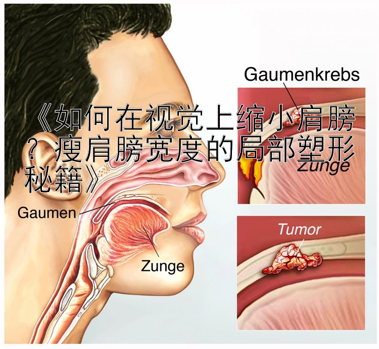 《如何在視覺上縮小肩膀？瘦肩膀?qū)挾鹊木植克苄蚊丶? loading=