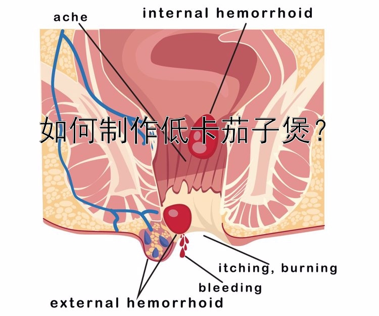 如何制作低卡茄子煲？