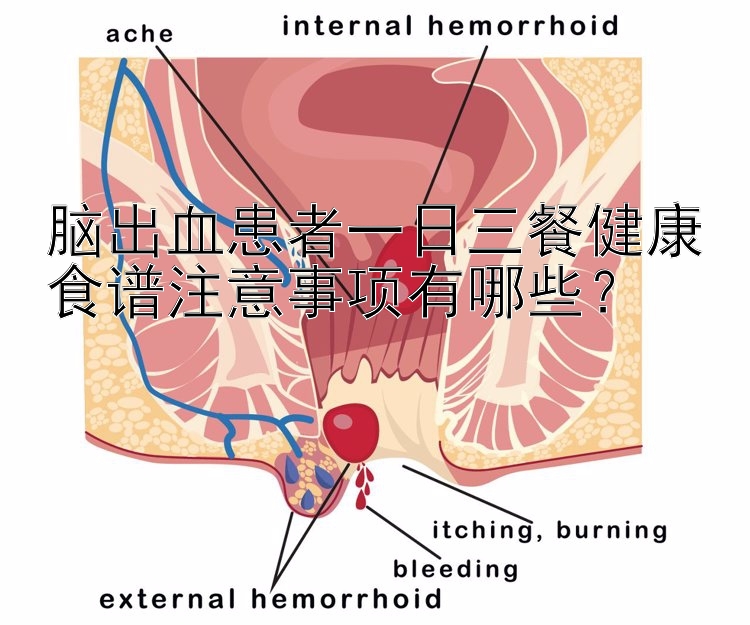 腦出血患者一日三餐健康食譜注意事項(xiàng)有哪些？